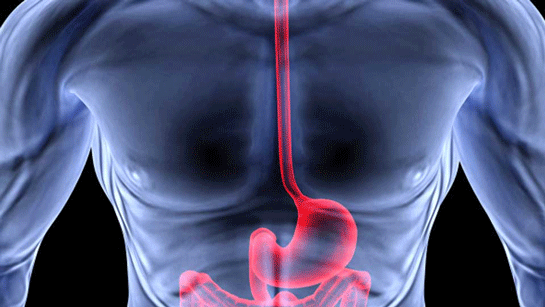 Reflünün Tedavisi Var mı?